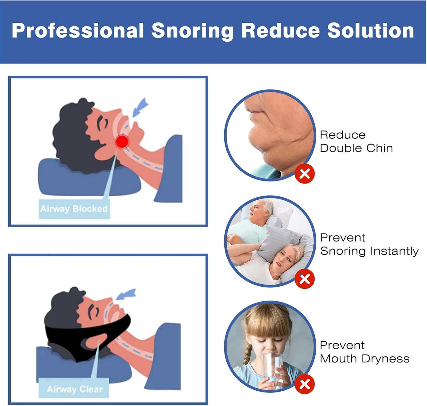Anti Snoring Chin Strap, Anti-Snoring Device, Easy-To-Wear Snoring Solution, Help You Close Your Mouth When You Sleep, Men and Women Can Use Chin Strap Black, 50CM